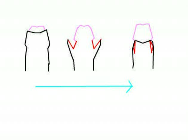 仮性包茎 -私は21歳の大学生なんですが、仮性包茎です。 今までは勃起時に- | OKWAVE