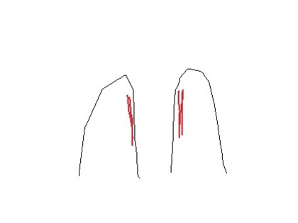 革靴がすぐ傷ついてしまいます , 靴・シューズ 締切済み